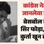 Video:गाजियाबाद में यूथ कांग्रेस जिलाध्यक्ष आसिफ सैफी पर बेसबॉल बैट से हमला, सिर फूटा; कार के शीशे तोड़े – Ghaziabad Youth Congress District President Asif Saifi Attacked With Baseball Bat
