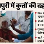 Stray Dogs Rampage In Shivpuri, Attacking Over 50 People In An Hour, Scratching 2-year-old Vedika’s – Madhya Pradesh News
