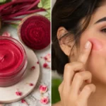 महंगे Blush की छुट्टी, चुकंदर से घर पर बनाएं नेचुरल क्रीम ब्लश