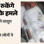 कुत्तों ने मासूम के पूरे शरीर पर दिए जख्म:घर जाते समय बोला हमला, दोनों हाथ-पांव समेत अन्य जगह काटा; गंभीर – Dogs Inflicted Wounds All Over Innocent Child S Body