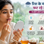 रिश के मौसम में फट रहे हैं होंठ? ये छोटी-छोटी बातें आएंगी काम