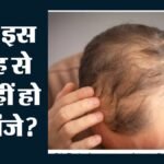 वजन घटाने की दवाओं से गंजेपन का खतरा:ओजेम्पिक-वेगोवी पर नया अध्ययन, आनुवंशिक जोखिम में 7% इजाफा – Ozempic Wegovy Zepbound Hair Loss Risk Genetic Baldness